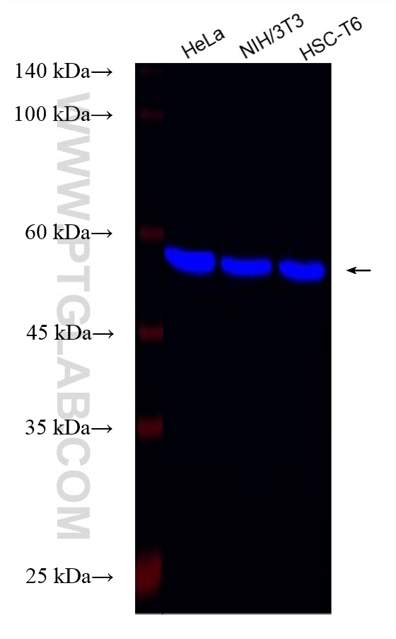 Beta Tubulin