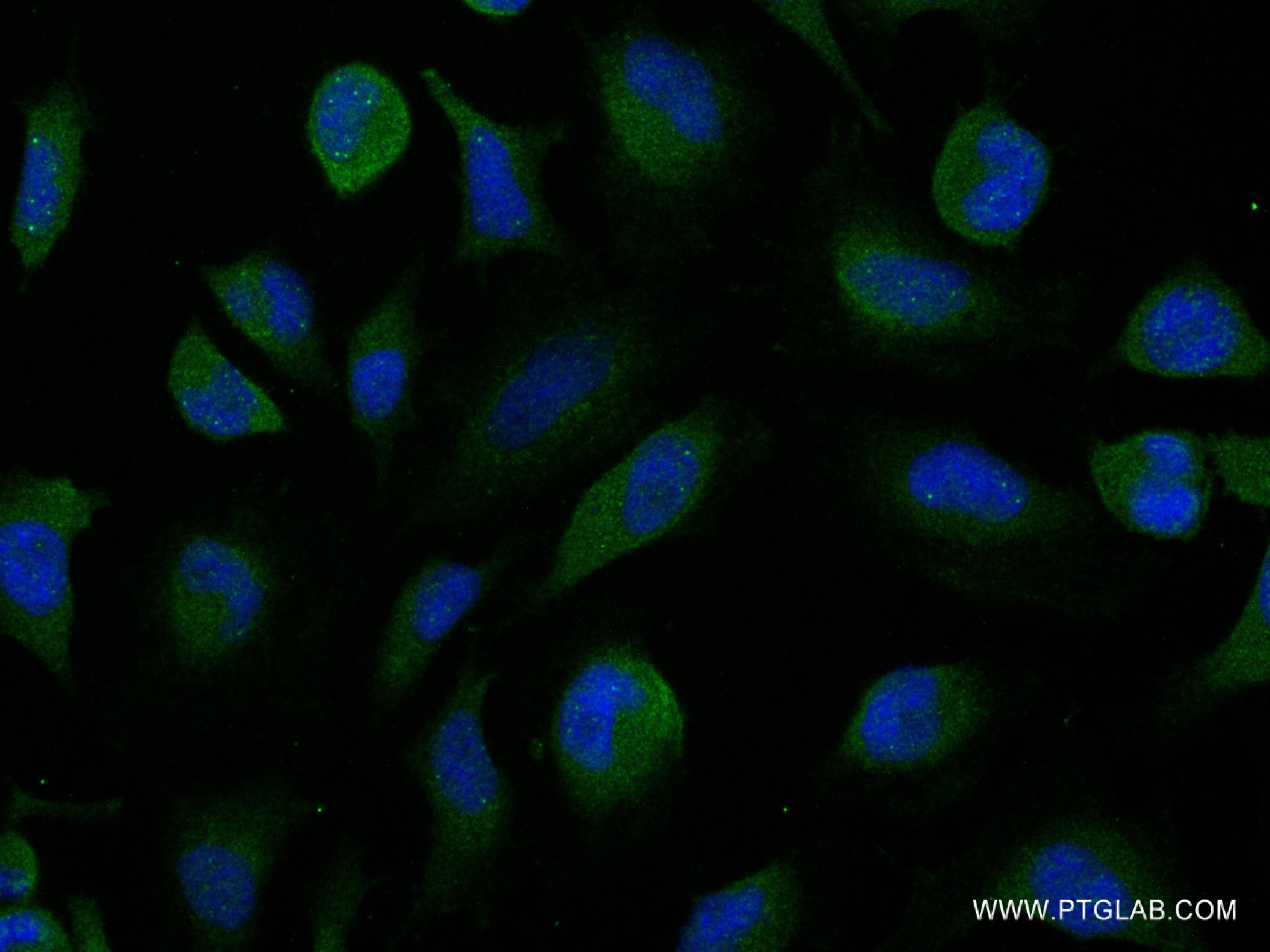 IF Staining of HeLa using 83715-1-RR