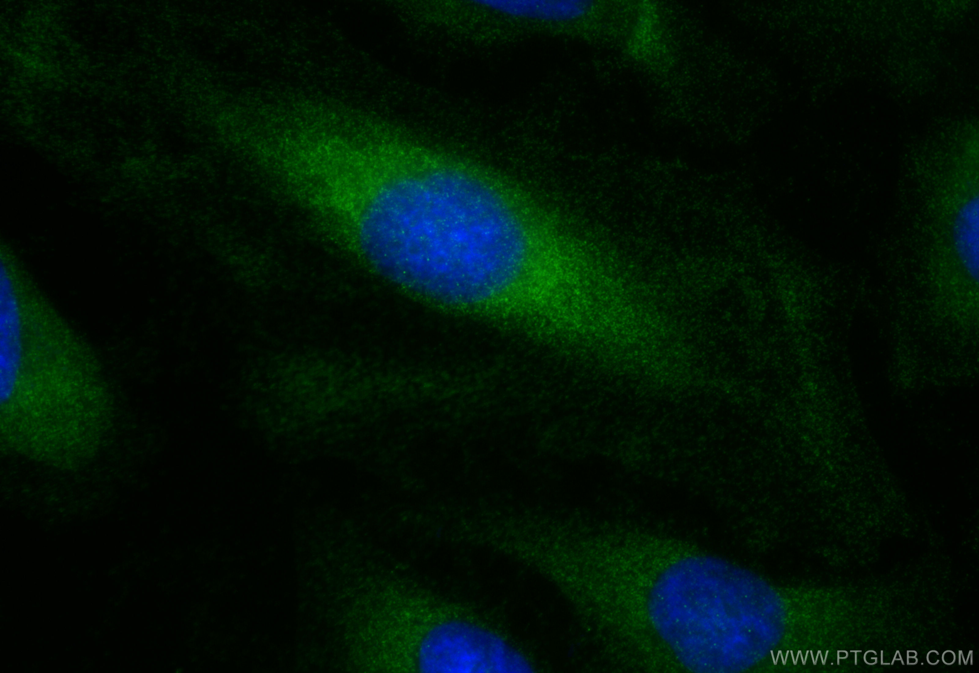 IF Staining of HeLa using 83715-1-RR