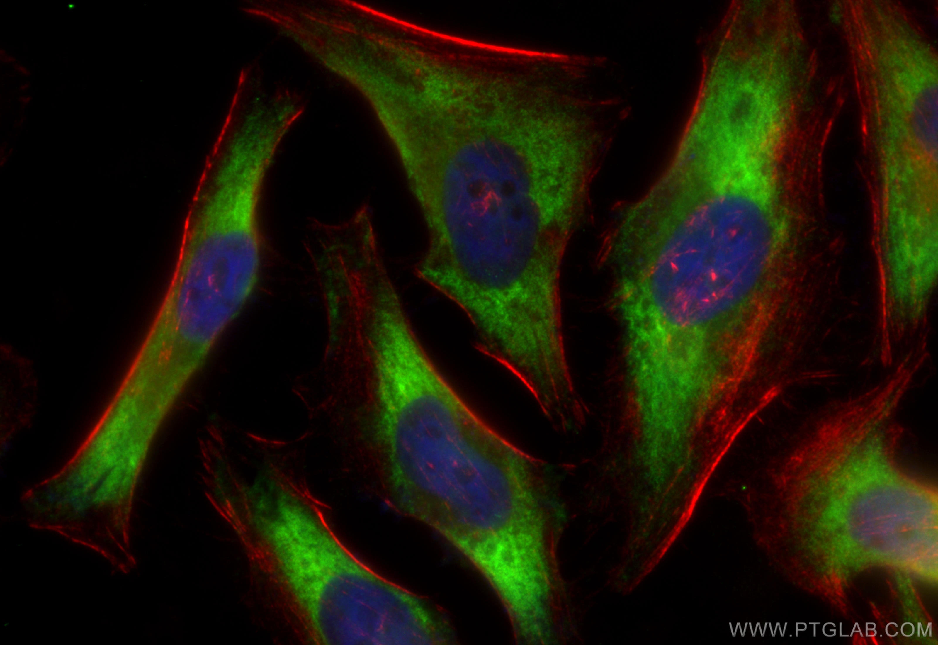 IF Staining of HeLa using CL488-83715