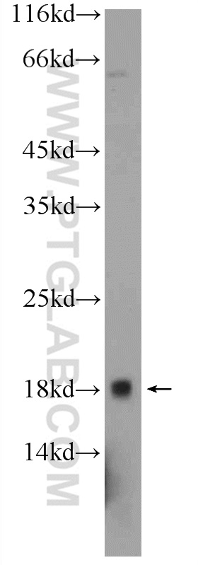 WB analysis of PC-3 using 24459-1-AP (same clone as 24459-1-PBS)