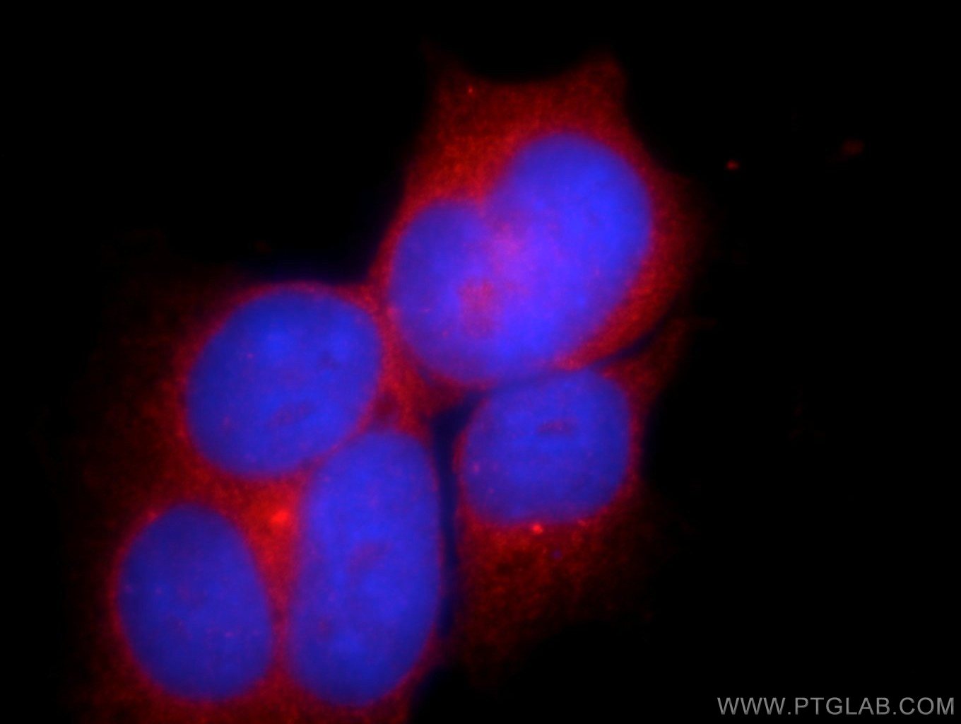 IF Staining of HEK-293 using 24975-1-AP