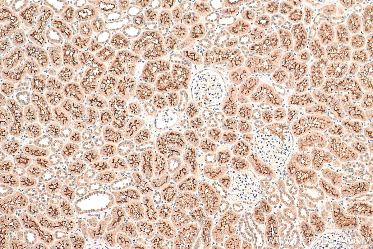 IHC staining of human kidney using 24975-1-AP