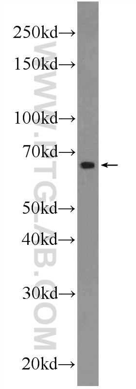 WB analysis of A549 using 24975-1-AP