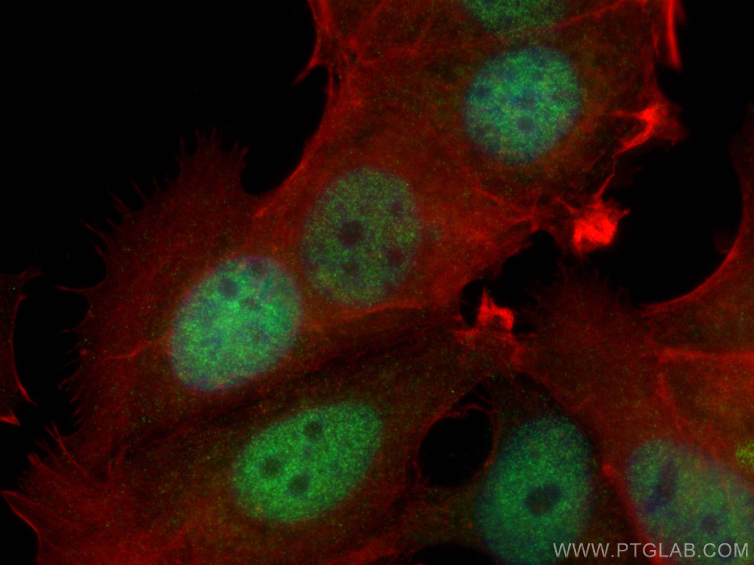 IF Staining of MCF-7 using 26212-1-AP