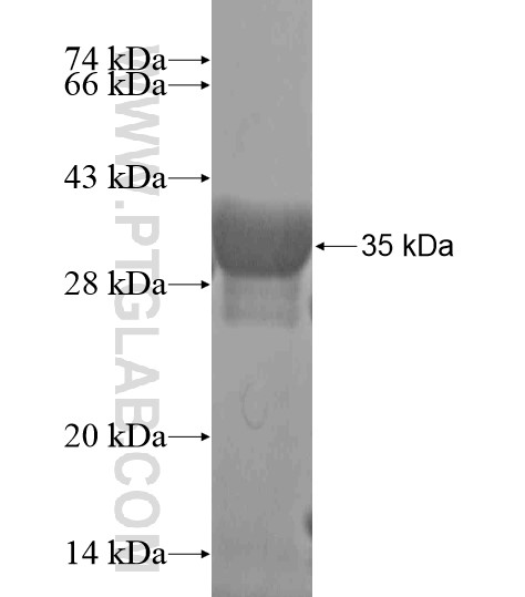 C11orf31 fusion protein Ag20591 SDS-PAGE