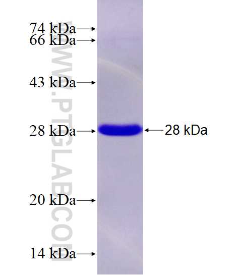 C11orf35 fusion protein Ag28100 SDS-PAGE