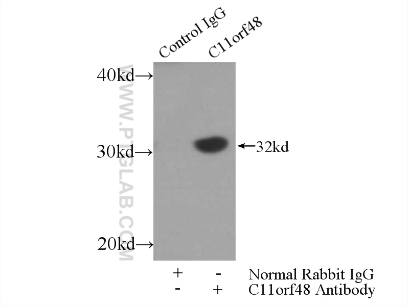 IP experiment of HepG2 using 24389-1-AP