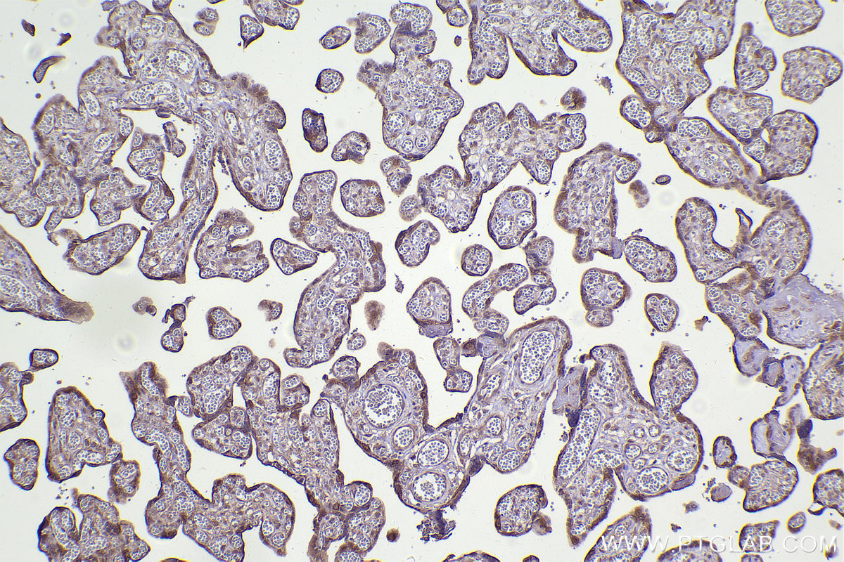 IHC staining of human placenta using 20409-1-AP