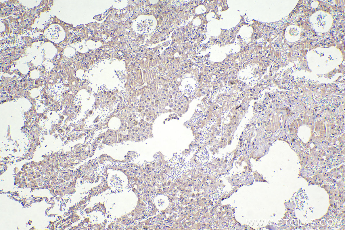 IHC staining of human lung using 20409-1-AP