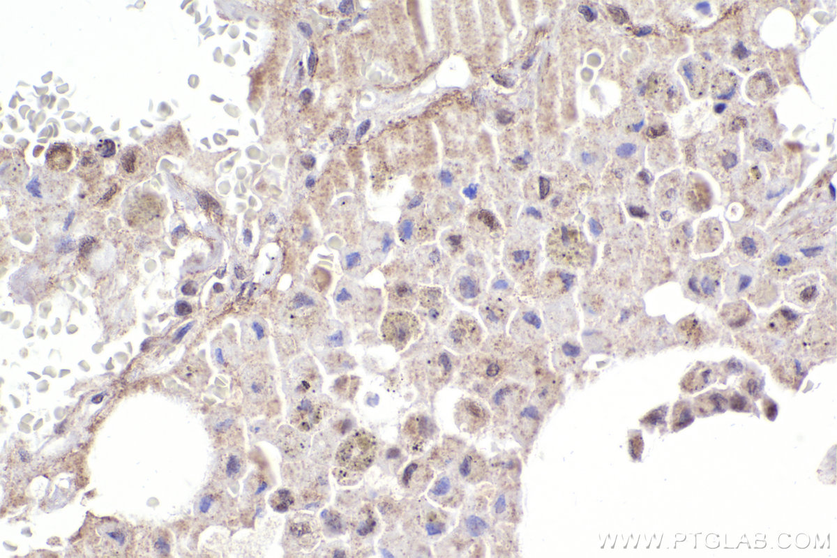 IHC staining of human lung using 20409-1-AP