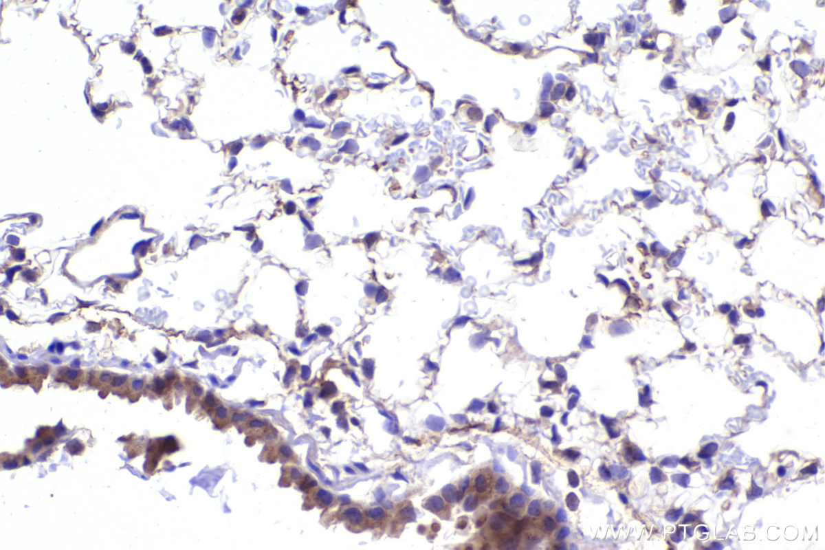 IHC staining of mouse lung using 20409-1-AP