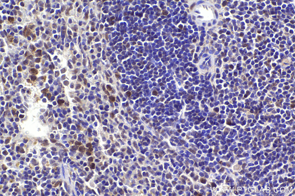 IHC staining of mouse spleen using 20409-1-AP