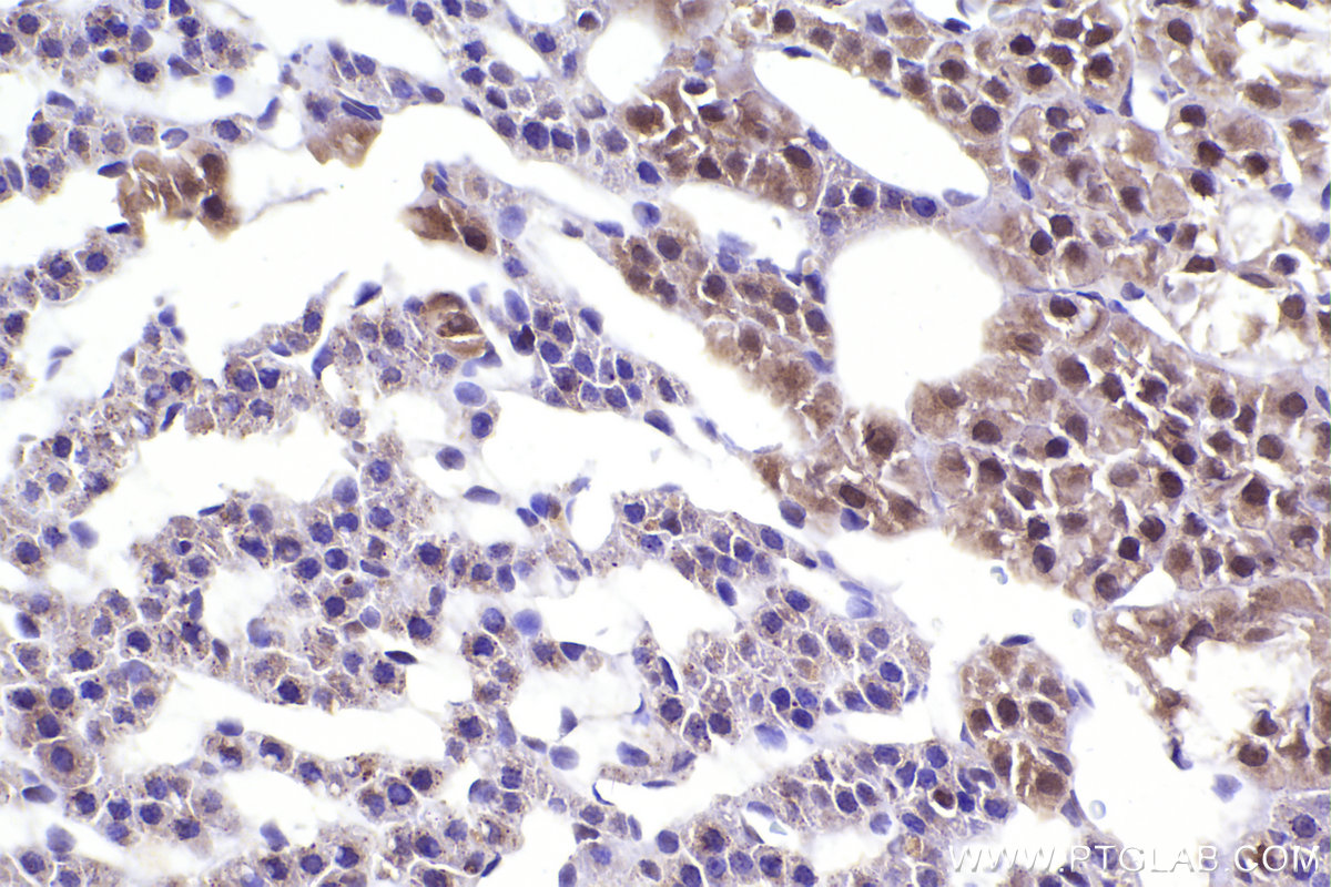 IHC staining of rat adrenal gland using 20409-1-AP