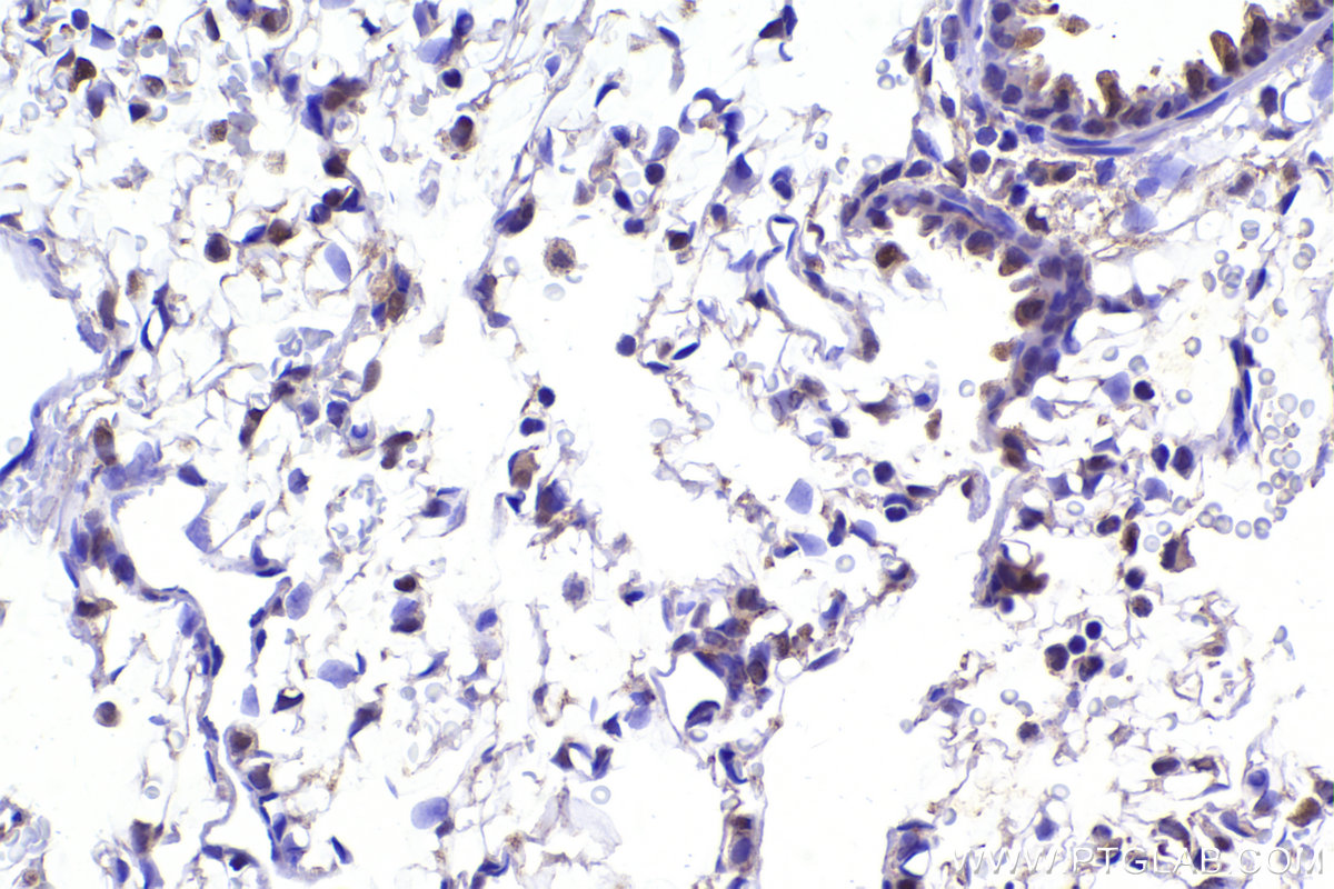 IHC staining of rat lung using 20409-1-AP