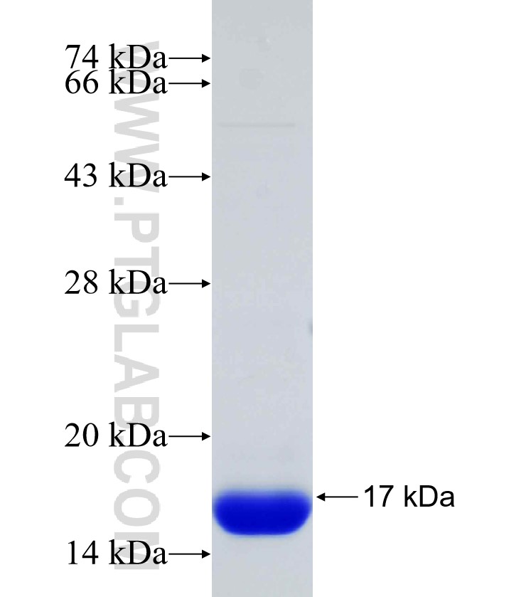 C11orf59 fusion protein Ag31234 SDS-PAGE