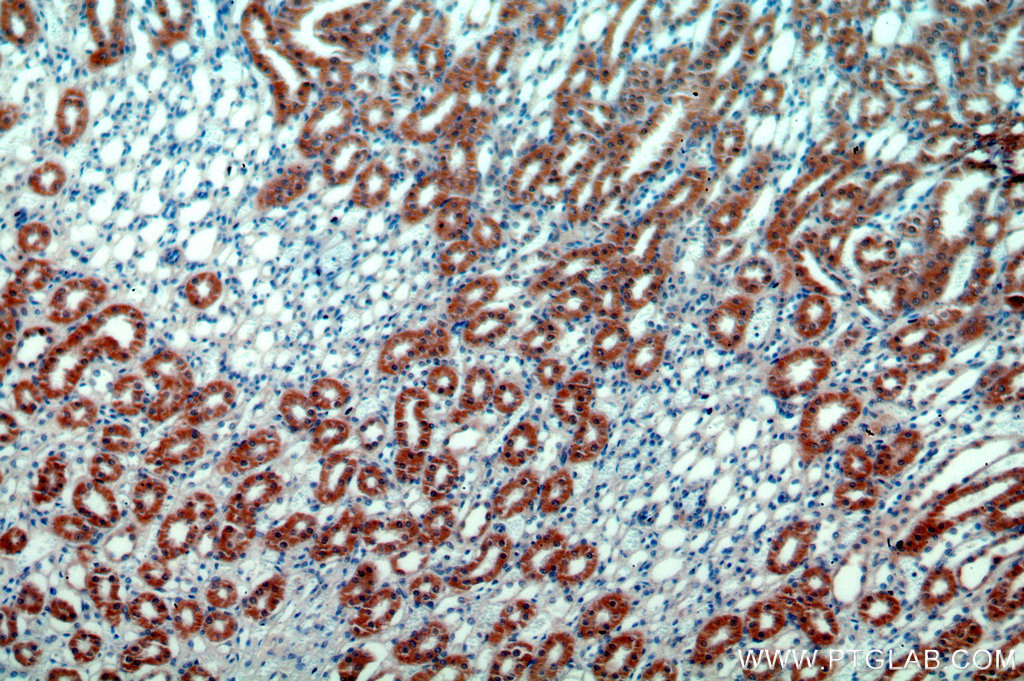 IHC staining of human kidney using 14808-1-AP