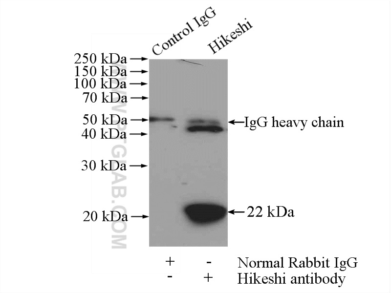 IP experiment of mouse brain using 14808-1-AP