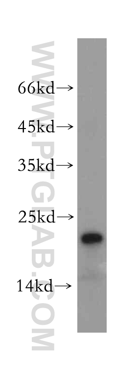 WB analysis of mouse kidney using 14808-1-AP