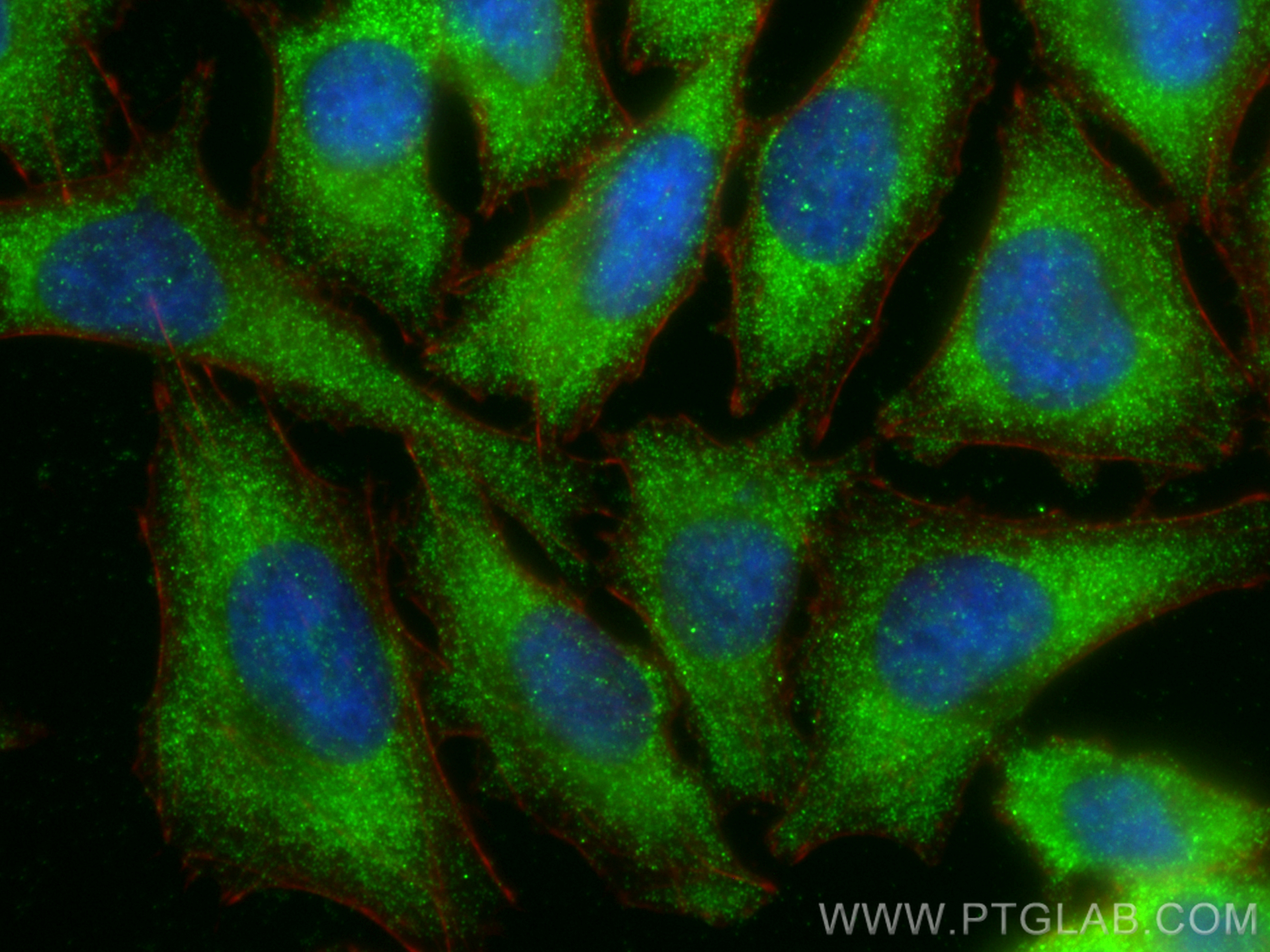 IF Staining of A375 using 20524-1-AP