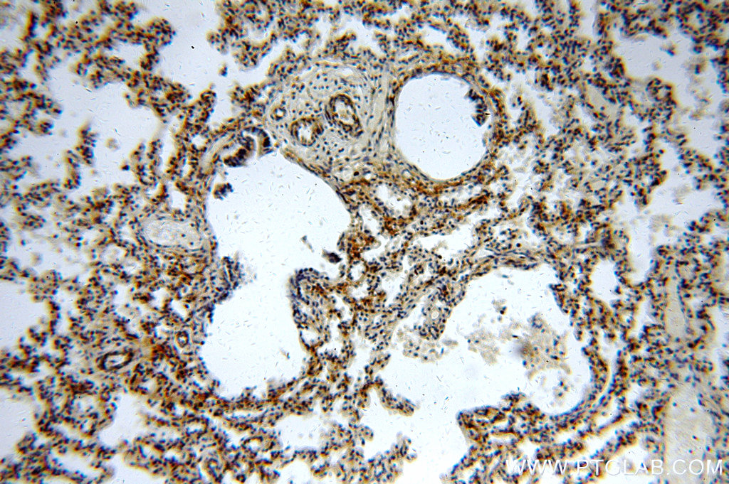 IHC staining of human lung using 20524-1-AP