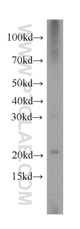 WB analysis of PC-3 using 20524-1-AP