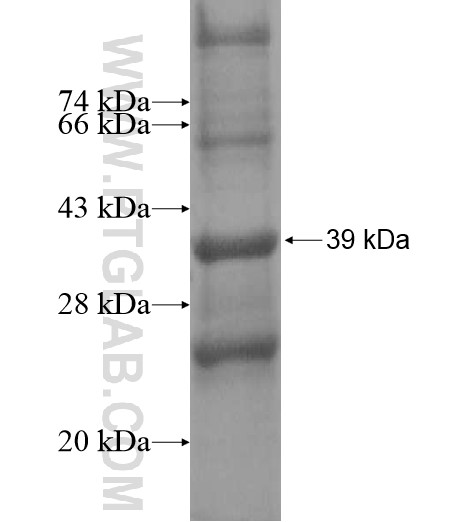 C11orf76 fusion protein Ag13880 SDS-PAGE