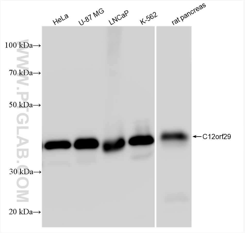 WB analysis of HeLa using 84708-1-RR (same clone as 84708-1-PBS)