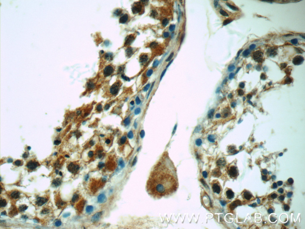 IHC staining of human testis using 25177-1-AP