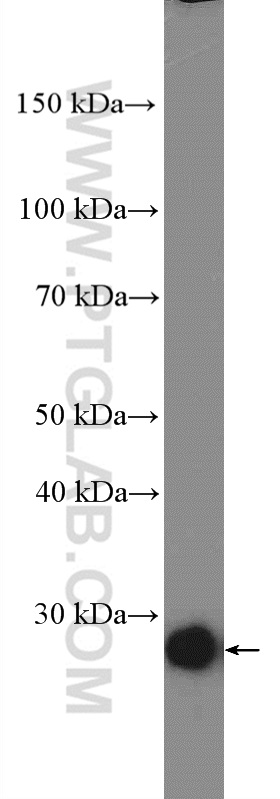 WB analysis of human testis using 25408-1-AP