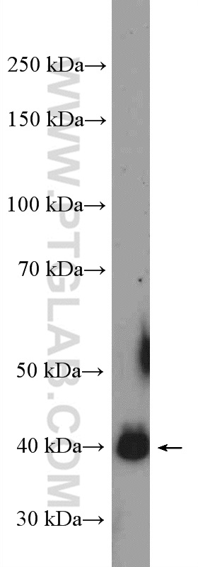 WB analysis of HepG2 using 26137-1-AP