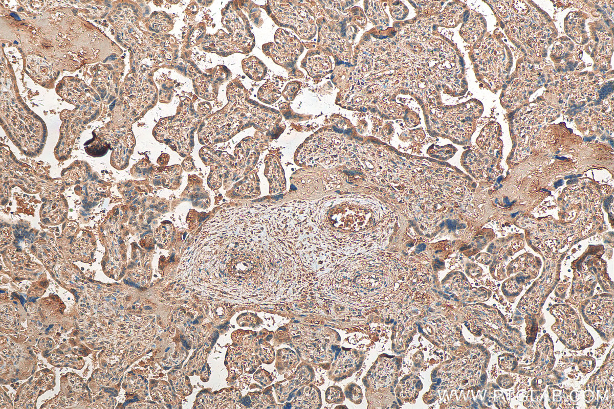 IHC staining of human placenta using 24824-1-AP