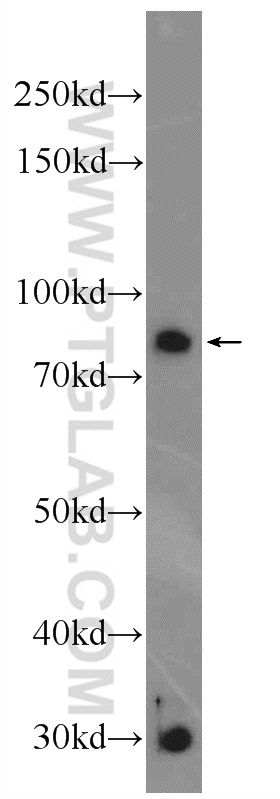 WB analysis of SGC-7901 using 24824-1-AP