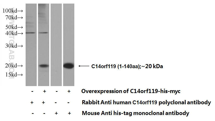 C14orf119