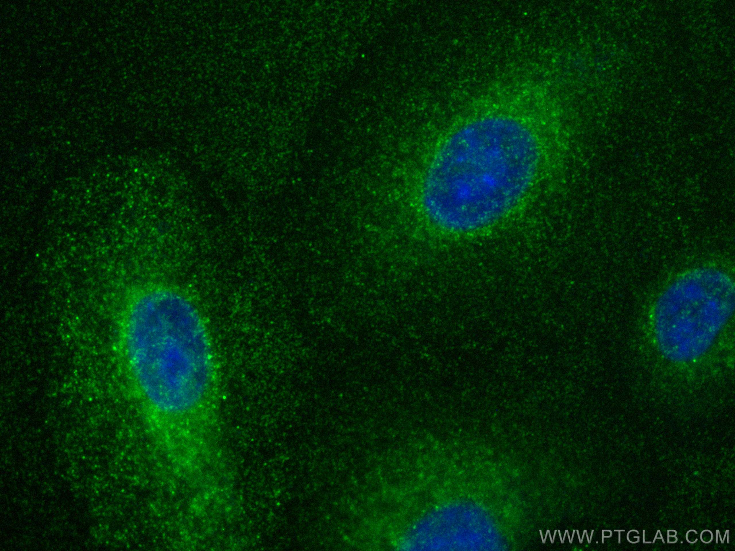 IF Staining of A549 using 23923-1-AP