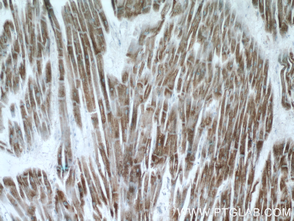 IHC staining of human heart using 14704-1-AP