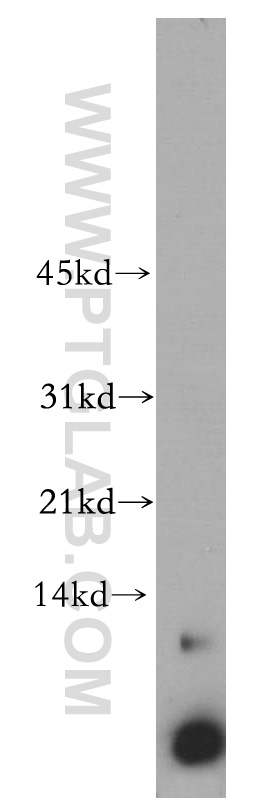 WB analysis of Jurkat using 14704-1-AP