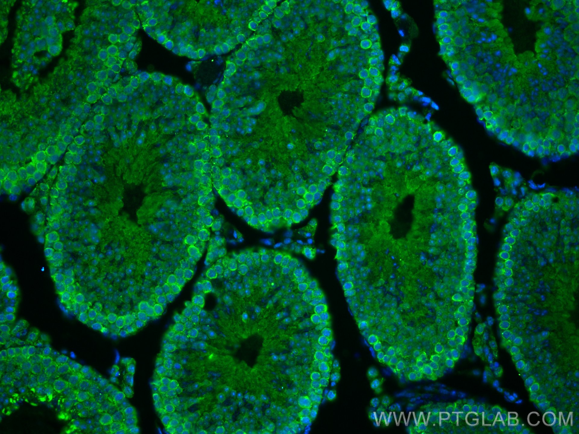 IF Staining of mouse testis using 22664-1-AP