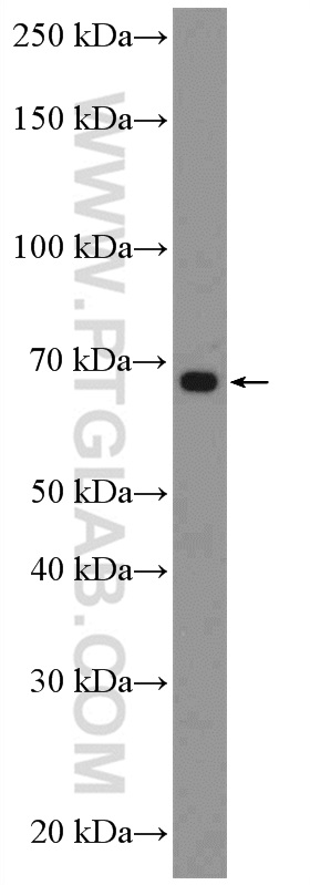 WB analysis of MCF-7 using 26395-1-AP