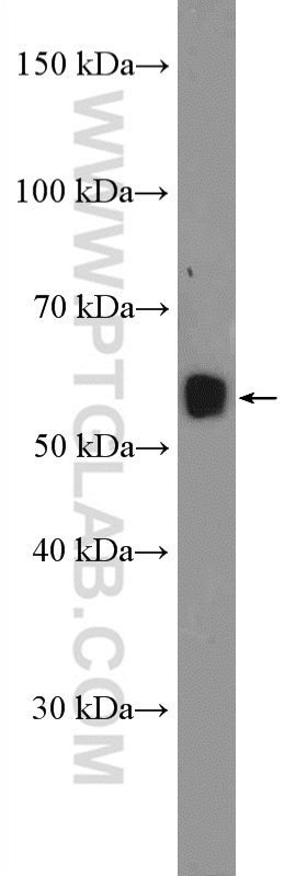 WB analysis of mouse liver using 26094-1-AP