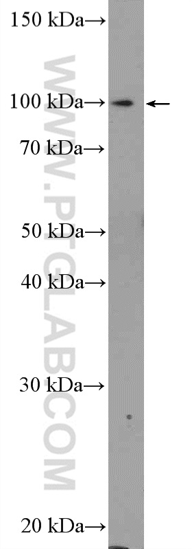 WB analysis of HEK-293 using 20126-1-AP