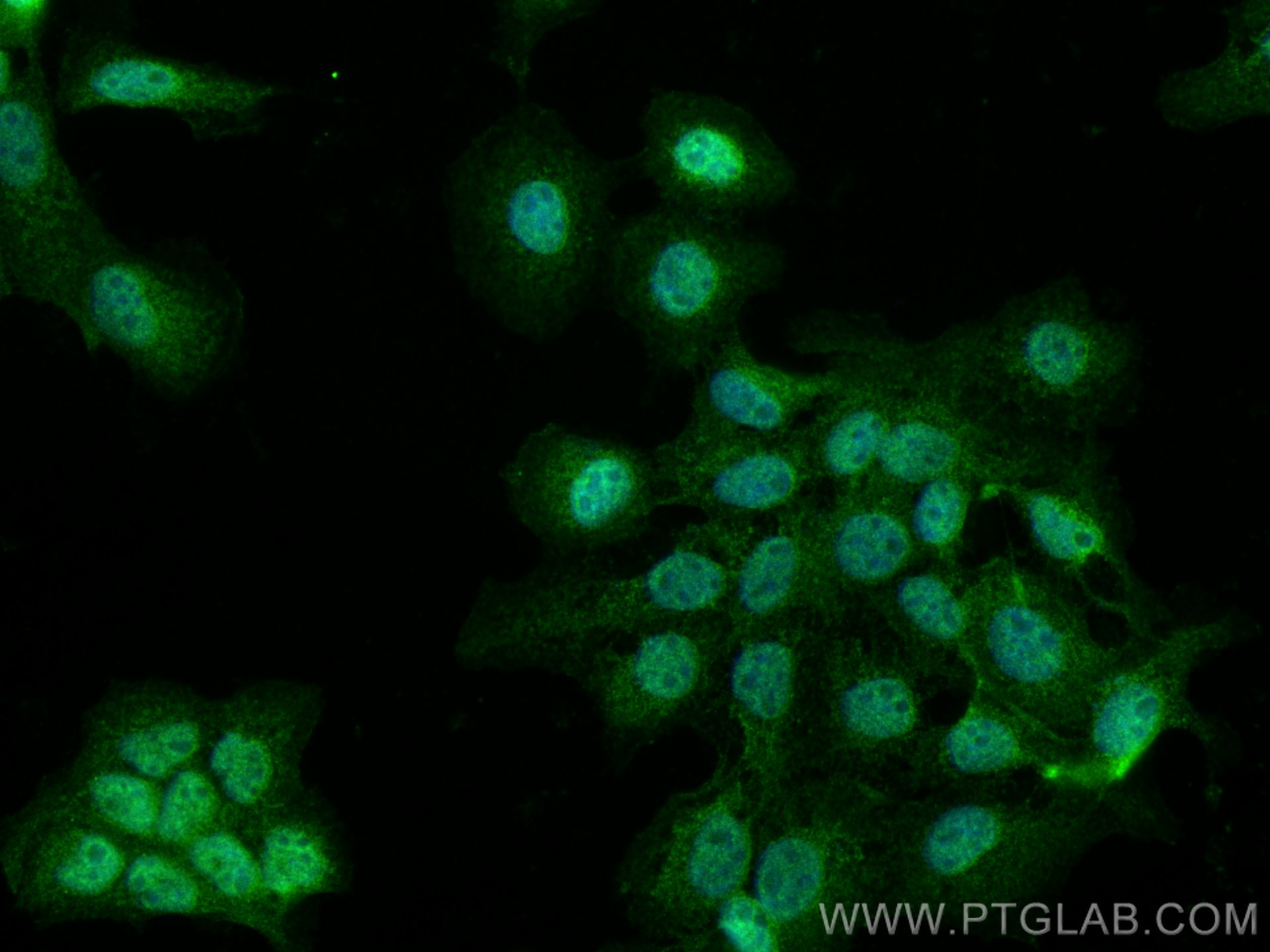 IF Staining of A431 using 28639-1-AP