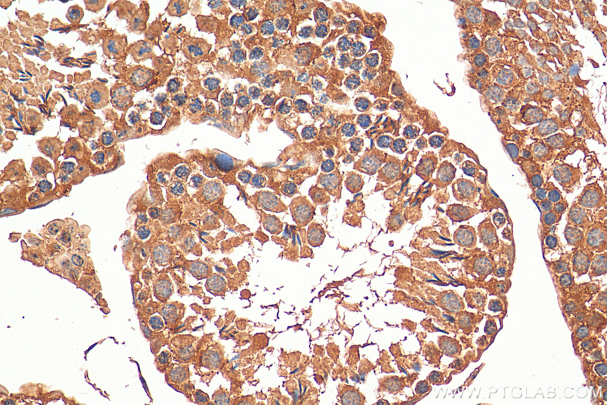 IHC staining of mouse testis using 28639-1-AP