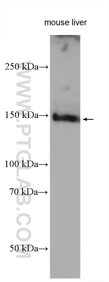 WB analysis using 28639-1-AP