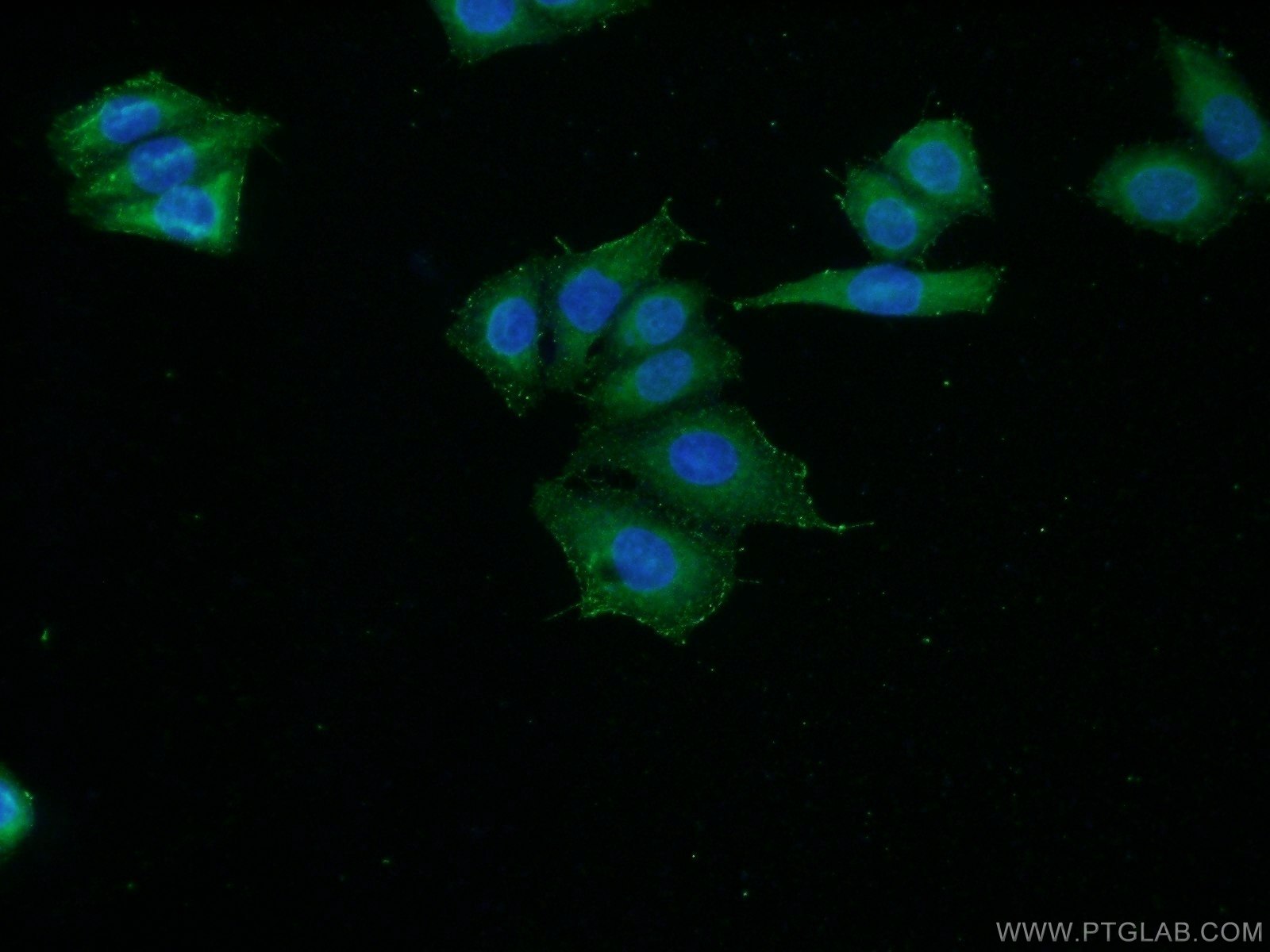 IF Staining of HeLa using 20801-1-AP