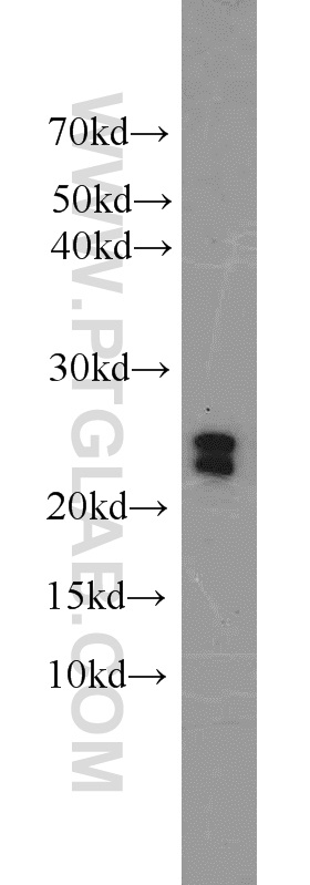 WB analysis of mouse liver using 20801-1-AP