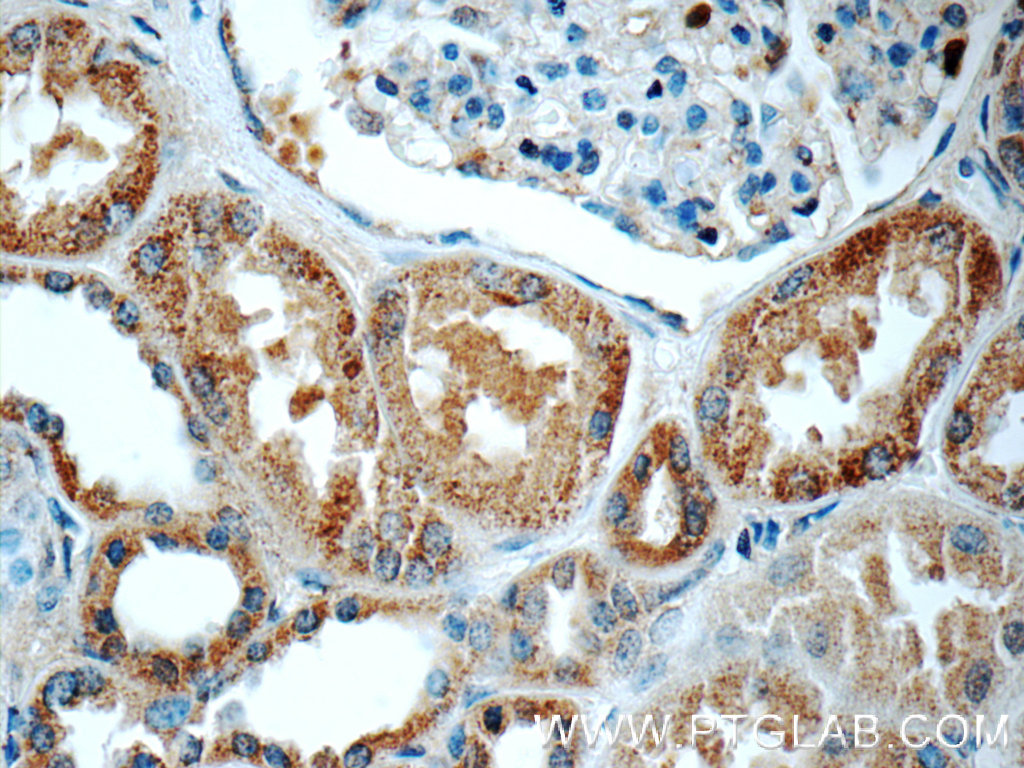 IHC staining of human kidney using 23337-1-AP