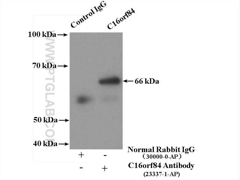 IP experiment of HepG2 using 23337-1-AP