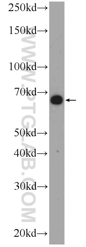 WB analysis of HepG2 using 23337-1-AP