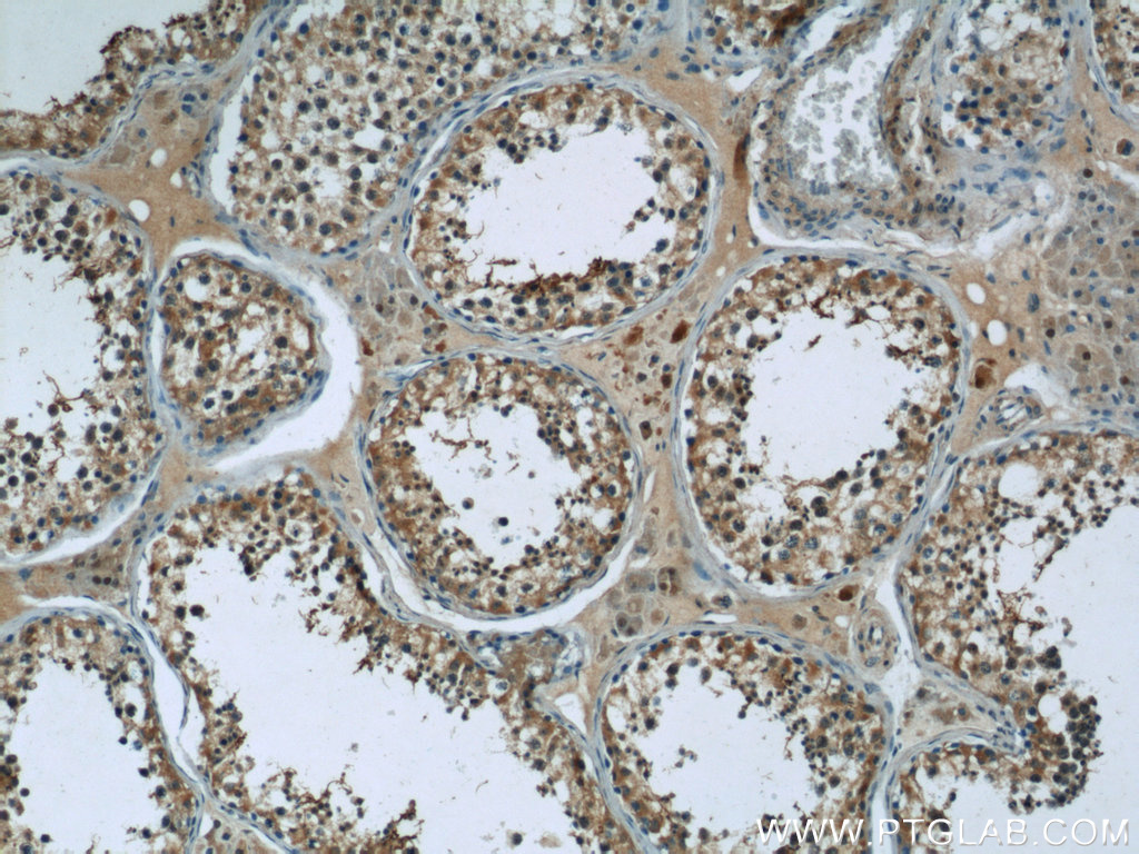 IHC staining of human testis using 24629-1-AP